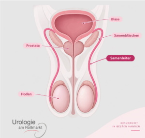 Frankfurt Am Main Vasektomie Minimalinvasiv Urologie Am Roßmarkt